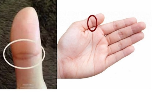 Giải mã vận mệnh người có vân mắt phượng ở ngón tay cái