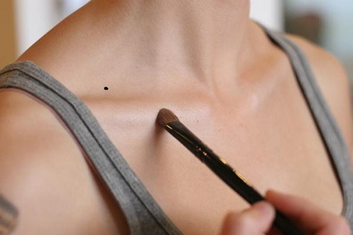 5 nốt ruồi nguy hiểm dễ huỷ hoại vận thế cả một đời