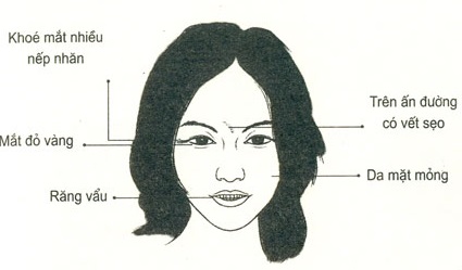 Những nét tướng của phụ nữ Xấu từ trong trứng nước mà các cụ xưa luôn ngăn cản không cho con cháu lấy làm vợ