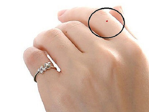 Những nốt ruồi quý nhân mang lại tài lộc và giàu sang